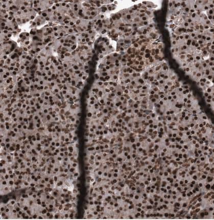 Immunohistochemistry-Paraffin SNRK Antibody