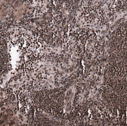 Immunohistochemistry-Paraffin: SNRK Antibody [NBP1-83668] -Staining of human lymphoid tissues shows strong nuclear positivity in non-germinal center cells.