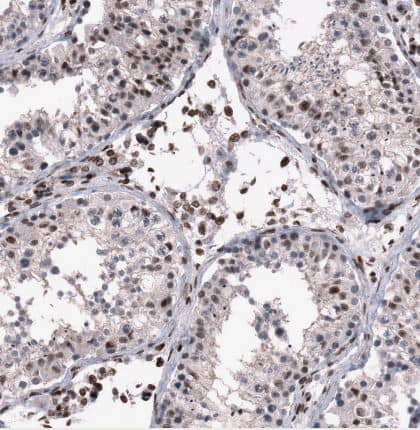 Immunohistochemistry-Paraffin: SNRK Antibody [NBP1-83668] -Staining of human testis shows strong nucleus positivity in endothelial cells, leydig cells and moderate nucleus positivity in cells in seminiferous cells.