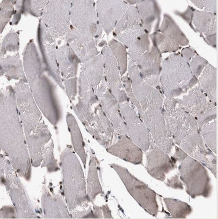 Immunohistochemistry-Paraffin: SNRK Antibody [NBP1-83668] -Staining of human skeletal muscle shows strong nuclear positivity in myocytes.