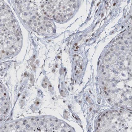 Immunohistochemistry-Paraffin RFX7 Antibody