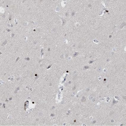 Immunohistochemistry-Paraffin RFX7 Antibody