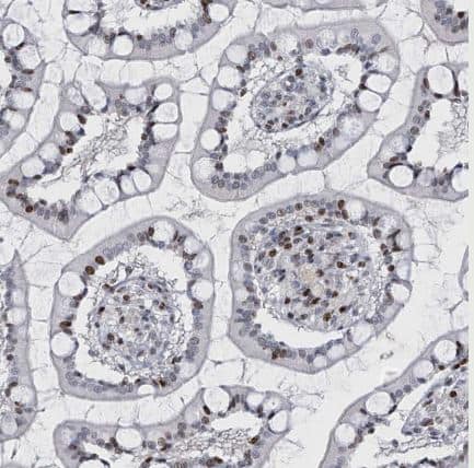 Immunohistochemistry-Paraffin RFX7 Antibody