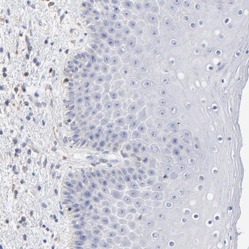 Staining of human skin shows no positivity in squamous epithelial cells as expected.