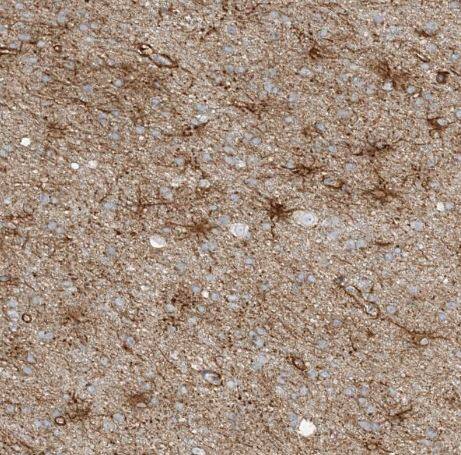 Immunohistochemistry-Paraffin: PLEKHA3 Antibody [NBP1-83924] - Staining of human cerebral cortex shows strong cytoplasmic positivity in astrocytes.