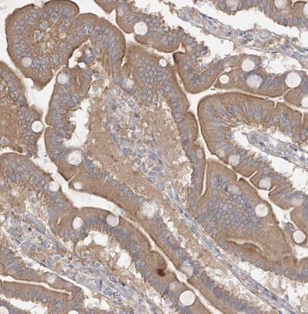 Immunohistochemistry-Paraffin: PLEKHA3 Antibody [NBP1-83924] - Staining of human duodenum shows moderate cytoplasmic-membranous positivity in glandular cells. 