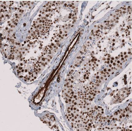 Immunohistochemistry-Paraffin MMRN2 Antibody