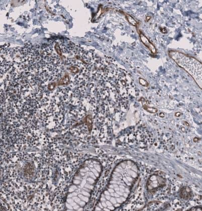 Immunohistochemistry-Paraffin MMRN2 Antibody