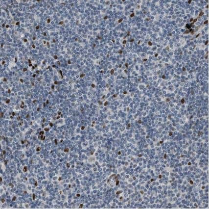 Immunohistochemistry-Paraffin: ZBTB20 Antibody [NBP1-84146] - Staining of human tonsil shows strong nuclear positivity in non-germinal center cells.
