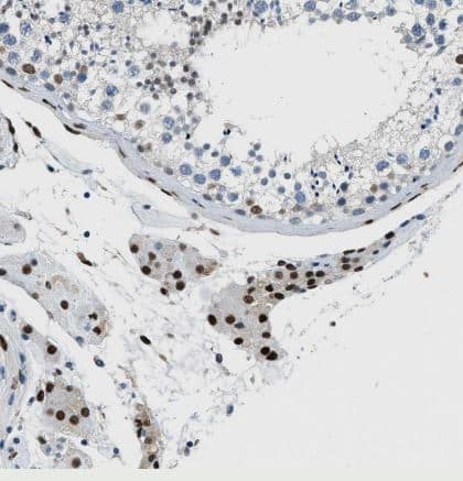 Immunohistochemistry-Paraffin: ZBTB20 Antibody [NBP1-84146] -Staining of human testis shows strong nuclear positivity in Leydig cells.
