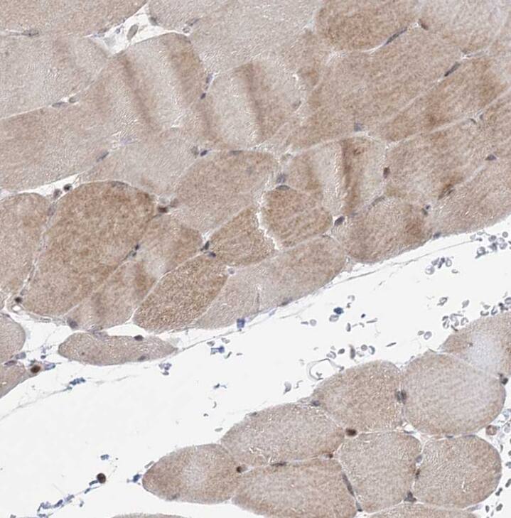 Immunohistochemistry-Paraffin ANAPC15 Antibody - BSA Free