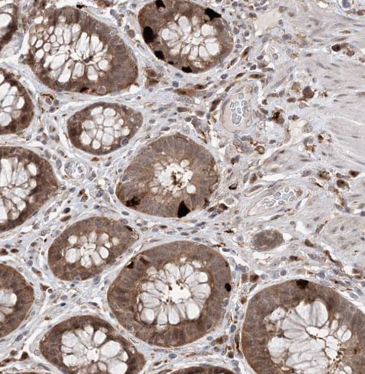 Immunohistochemistry-Paraffin ANAPC15 Antibody - BSA Free