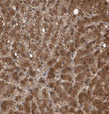 Immunohistochemistry-Paraffin: LMAN2L Antibody [NBP1-84152] - Staining of human liver shows strong granular cytoplasmic positivity in hepatocytes.