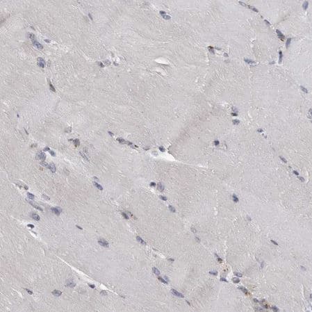 Immunohistochemistry-Paraffin: LMAN2L Antibody [NBP1-84152] - Staining of human skeletal muscle shows no positivity in myocytes as expected.