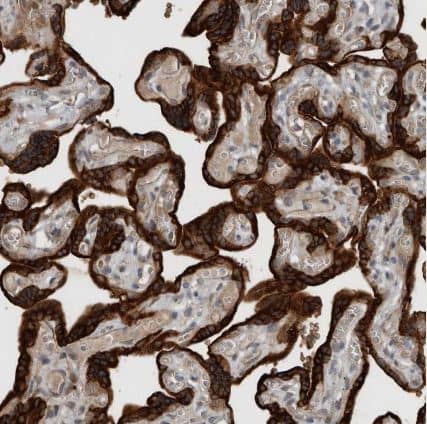 Immunohistochemistry-Paraffin: YOD1 Antibody [NBP1-84172] - Staining of human placenta shows strong cytoplasmic positivity in trophoblastic cells.