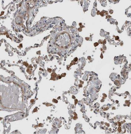 Immunohistochemistry-Paraffin: YOD1 Antibody [NBP1-84172] - Staining of human lung shows strong cytoplasmic positivity in macrophages.