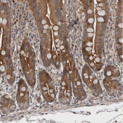 Immunohistochemistry-Paraffin: YOD1 Antibody [NBP1-84172] -Staining of human duodenum shows strong cytoplasmic positivity in glandular cells.