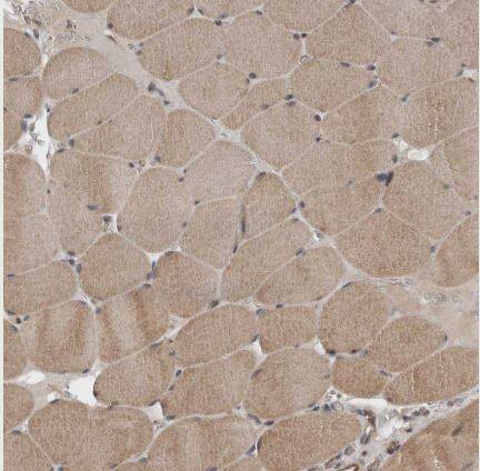 Immunohistochemistry-Paraffin: YOD1 Antibody [NBP1-84172] - Staining of human skeletal muscle shows moderate cytoplasmic positivity in myocytes.