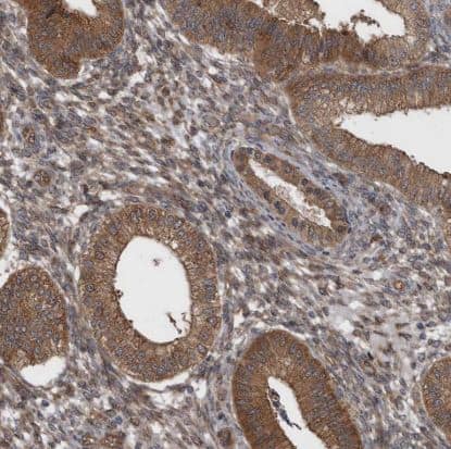 Immunohistochemistry-Paraffin: RAB3GAP2 Antibody [NBP1-84199] -Staining of human endometrium shows strong cytoplasmic positivity in glandular cells.