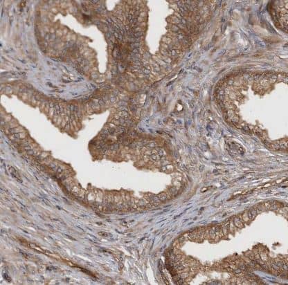 Immunohistochemistry-Paraffin: RAB3GAP2 Antibody [NBP1-84199] -Staining of human prostate shows moderate cytoplasmic positivity in glandular cells.