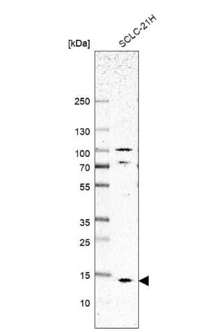 Western Blot: SMIM8 Antibody [NBP1-84249] - Analysis in human cell line SCLC-21H.