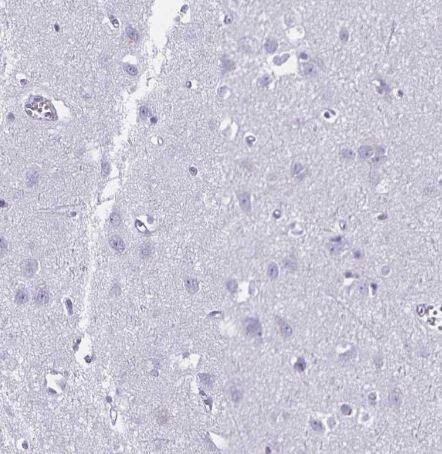 DEFA6 Antibody [NBP1-84281]-Staining of human cerebral cortex shows no cytoplasmic positivity in neuronal cells as expected.