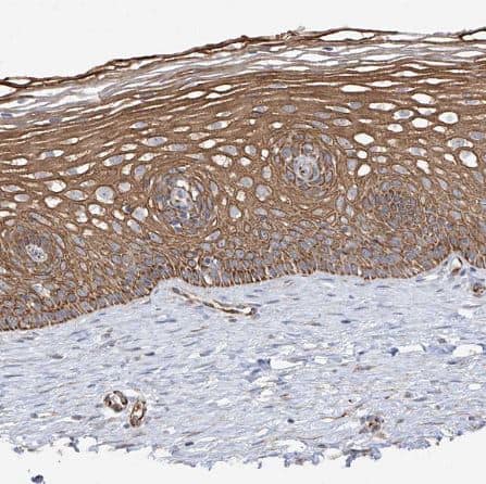 Immunohistochemistry-Paraffin: DCDC2 Antibody [NBP1-84298] - Staining of human cervix shows moderate membranous positivity in squamous epithelial cells.