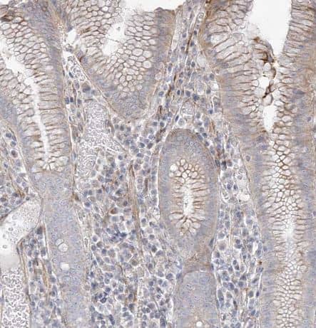 Immunohistochemistry-Paraffin: DCDC2 Antibody [NBP1-84298] - Staining of human stomach shows moderate membranous positivity in glandular cells.