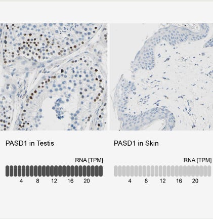 Immunohistochemistry-Paraffin PASD1 Antibody