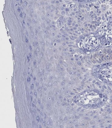 Immunohistochemistry: CRYGS Antibody [NBP1-84375] - Staining of human skin shows no cytoplasmic positivity in squamous epithelial cells as expected.