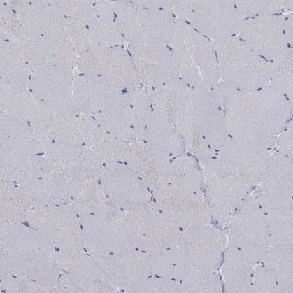 Immunohistochemistry: CRYGS Antibody [NBP1-84375] -Staining of human skeletal muscle shows no cytoplasmic positivity in myocytes as expected.