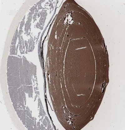 Immunohistochemistry-Paraffin CRYGS Antibody