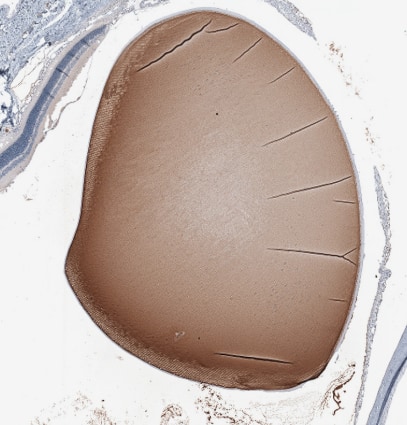 Immunohistochemistry-Paraffin CRYGS Antibody