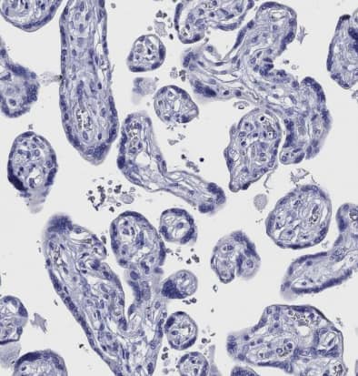 Immunohistochemistry: CRYGS Antibody [NBP1-84375] -Staining of human placenta shows no cytoplasmic positivity in trophoblastic cells as expected.