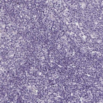 Immunohistochemistry-Paraffin: SH3GL3 Antibody [NBP1-84419] - Staining of human tonsil shows no positivity in non-germinal center cells as expected.