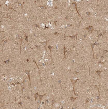 Immunohistochemistry-Paraffin: NT5C Antibody [NBP1-84563] -Staining of human cerebral cortex shows moderate cytoplasmic positivity in neuronal cells.