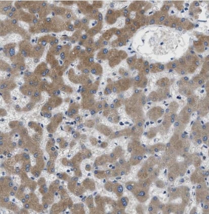 Immunohistochemistry-Paraffin MPDU1 Antibody