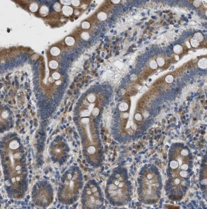 Immunohistochemistry-Paraffin MPDU1 Antibody