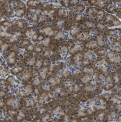 Immunohistochemistry-Paraffin MPDU1 Antibody