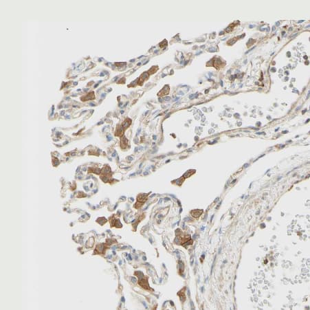 Immunohistochemistry-Paraffin: IKK gamma Antibody [NBP1-84681] - Staining of human lung shows moderate cytoplasmic positivity in macrophages.