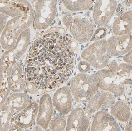 Immunohistochemistry-Paraffin: IKK gamma Antibody [NBP1-84681] -Staining of human kidney shows moderate cytoplasmic positivity in cells in glomeruli.