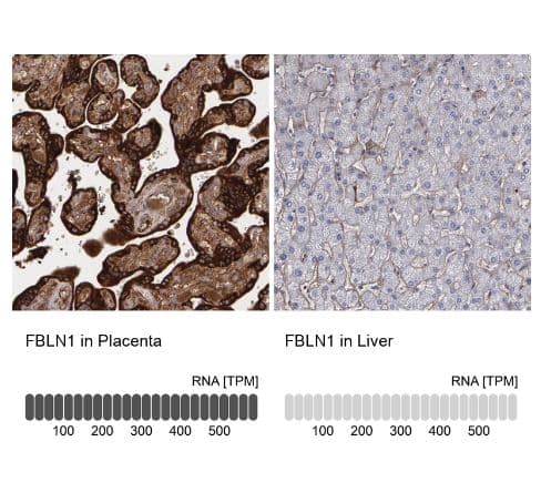 Immunohistochemistry-Paraffin: Fibulin 1 Antibody [NBP1-84726] - Analysis in human placenta and liver tissues using NBP1-84726 antibody. Corresponding FBLN1 RNA-seq data are presented for the same tissues.