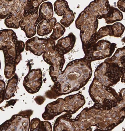 Immunohistochemistry-Paraffin: Fibulin 1 Antibody [NBP1-84726] -Staining of human placenta shows strong cytoplasmic positivity in trophoblastic cells.