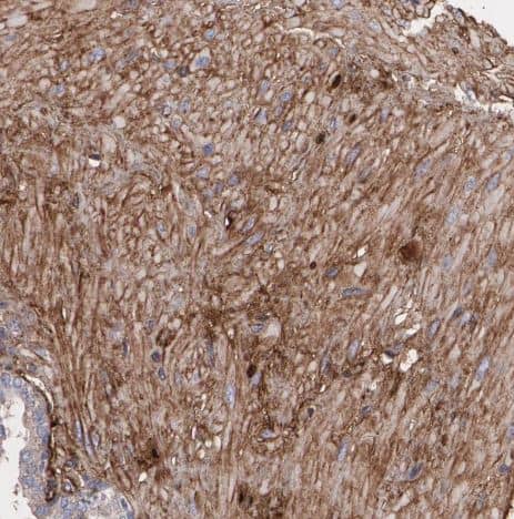 Immunohistochemistry-Paraffin: Fibulin 1 Antibody [NBP1-84726] -Staining of human prostate shows moderate cytoplasmic positivity in smooth muscle cells. 