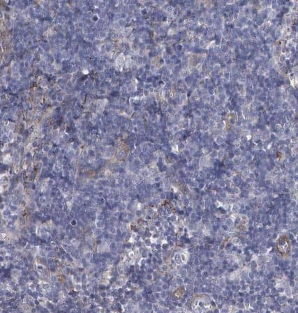 Immunohistochemistry-Paraffin: Fibulin 1 Antibody [NBP1-84726] -Staining of human lymph node shows very weak cytoplasmic positivity in non-germinal center cells.