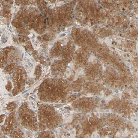 Immunohistochemistry-Paraffin: EphB3 Antibody [NBP1-84776] - Staining of human stomach shows moderate cytoplasmic positivity in glandular cells.