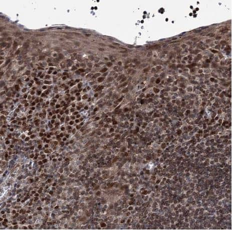 Immunohistochemistry-Paraffin: PHC3 Antibody [NBP1-84896] - Staining of human tonsil shows strong nuclear positivity in squamous epithelial cells.