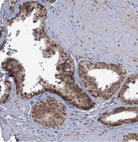 Immunohistochemistry-Paraffin: PHC3 Antibody [NBP1-84896] - Staining of human prostate shows strong nuclear positivity in glandular cells.