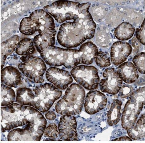 Immunohistochemistry-Paraffin: PHLDA1 Antibody [NBP1-84969] -Staining of human kidney shows strong cytoplasmic positivity in cells in proximal tubules.