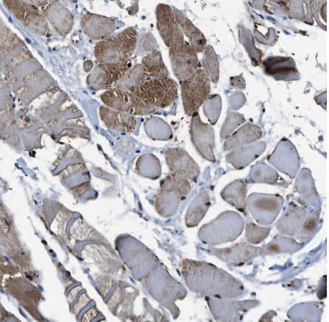 Immunohistochemistry-Paraffin: PHLDA1 Antibody [NBP1-84969] -Staining of human skeletal muscle shows moderate cytoplasmic positivity in myocytes.